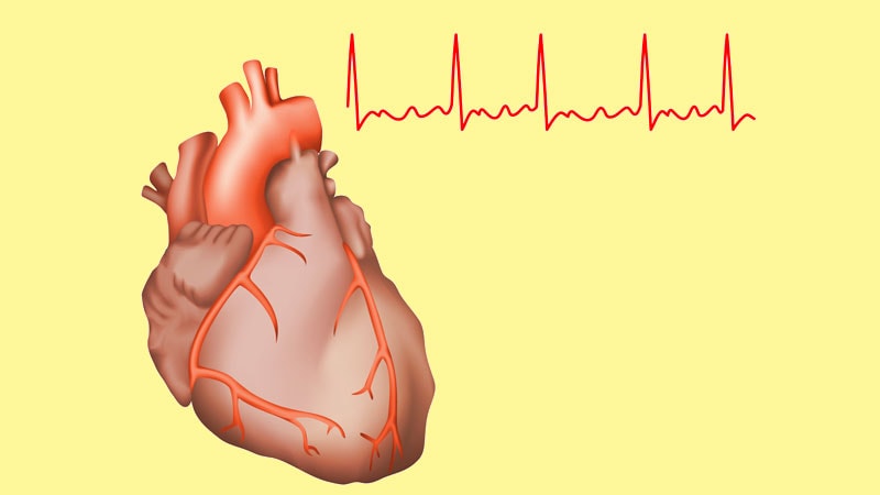 New AFib Guidelines Confront Underlying Illness